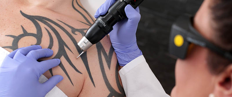 Till yrkesmässiga hygieniska verksamheter räknas bl.a. fotvård, massage, hårvård och tatuering.